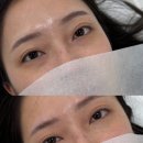 남구-142 | [광주 남구] 백운동 100% 예약제 1:1 관리 광주다크서클커버, 오닛