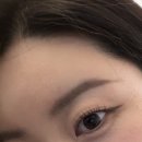 NO.1 자동차피부과 | 청담피부과 물광주사 후기 | 효과 언제부터 ? 중요한일정 화잘먹 피부 스틴부스터 no.1