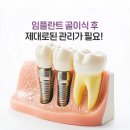 세종플란트 치과의원 이미지
