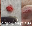 아이에스성형외과의원 이미지