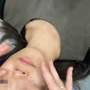 노아한의원 | 신정동 한의원 세연한의원 스킨부스터 라보센(Labossen) 후기