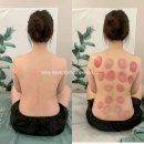 고은 에스테틱 | 정관 고은미학 에스테틱 리웨이브 에너지 테라피 후기