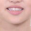 키다리아저씨 치과교정과 치과의원 이미지