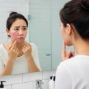 수진약국 | 다들 쓰길래 따라 쓴 아젤리아 크림, 정말 괜찮은 걸까요