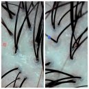 미스터독 힐링＆스파 | [부산 커플헤드스파] 스킨핏헤드스파(두피클리닉 이색데이트, 차별화된과정, 주차)