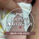 에스앤유의원 | 마포 공덕 에스앤유 혈관종 치료 비용 예약방법(9개월 아기)