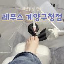 레푸스 계양구청점 | 레푸스 계양구청점 깔끔한 계산동 발톱무좀 관리 후기