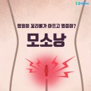 엉덩이 꼬리뼈가 아프고 염증이? '모소낭' 원인 이미지