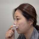 코알바 | 자가늑 코재수술 후기 비용 통증 흉터 무서웠던 수면마취 썰