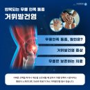 청라정형외과 무릎 안쪽 통증을 유발하는 거위발건염 증상부터 원인 총 정리 이미지
