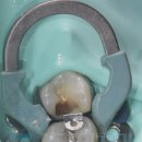 스카이치과기공소 이미지