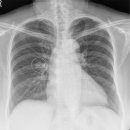 하나이비인후과병원 이미지