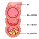 애견 고지혈 ( 무서운 피떡은 모든애견들에게 주의해야할 질환이다 ) 이미지