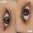 리메디뷰티아카데미룩서스플라즈마라이너노원지사