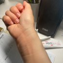 이대약국 | 성인 급성두드러기로 방문한 이대서울병원 응급실 진료후기 비용 주차비