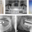 아이엠치과기공소 이미지