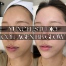 윤셀스튜디오 | 하남비비글로우 윤셀스튜디오 1:1 대표원장 시술 하남미사스킨케어