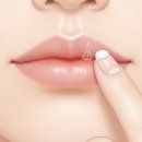 단순 포진 헤르페스, 입술 물집 연고 바르는 시기 이미지