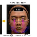 아트랩스킨