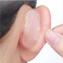 멍다방 | 신사역 귀필러 후기 누운귀 교정 멍 붓기 효과 찐리뷰