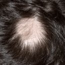 이성미베스트의원 | 평택 탈모치료 병원 이성미베스트의원