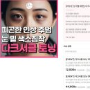 다크서클 레이저 토닝 끗 한의원 수원 1~2회차 후기