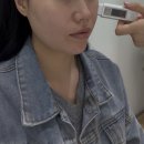 수원 인계동 피부관리 더라르떼 인계점_피부 장벽케어 후기