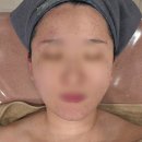 버블가이 | [진주에스테틱] 채움에스테틱 진주평거점에서 여드름관리 하고 온 후기