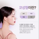 코끝수술후기 자연스러운 모습을 위해 살펴보아야 하는 것은