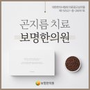 보명레이져
