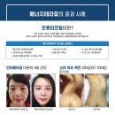 신기한 손 테라피