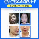 정우성형외과