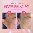 설탕창고