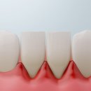 탑티어치과의원 이미지