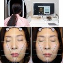 연합한의원 | 구안와사 한의원, 9년 고통 네 달 만에 끝낸 60대 환자분 회복 사례