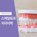 미백 이미지
