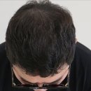 꽉찬두피