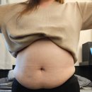 (주)강남제일 | 복부 지방흡입 직후 통증 후기 - 강남성형외과 고도비만 지흡 수술