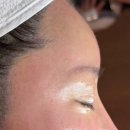 이미란 | 신촌 피부관리 고혹미 마포 슈퍼젝션으로 기미 색소 주름 케어 받은 솔직후기 (비포 애프터)