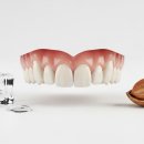 중원치과기공소 이미지