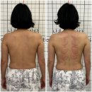 울산 통증관리 에너지테라피 등관리 후기 삼산동 나조각에스테틱