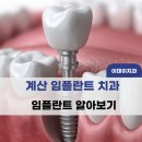 이데이치과의원 | 계산 임플란트 치과, 빠진 치아를 오래 두기 전에 확인해야 할 것들