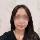 광주성형외과 | 광주성형외과 추천 !! 피부과 정품 리쥬란 받은 솔직한 후기 들려드려요, 병원추천