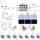 D00913 | 크립토탄시논, AMPK 활성화 및 해당 작용 억제를 통해 피부 흑색종 성장을 억제