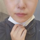 크리미의원 | [익산 모현동] 크리미의원 사각턱보톡스 후기!