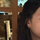 레스트(Rest) | 레스트 의원 내돈내산&엘란쎄 후기 (REST Clinic)
