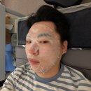 1회 사진기록전 | 남편 피부 고민으로 상담받은 첫 방문 기록, 피부관리 1회 후기