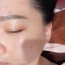 내면 | 대구동천동피부관리 ✨ 정명순내면미용 후기