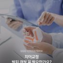구본준치과 교정과 치과의원 | 치아교정 발치결정 꼭 필요할까요?