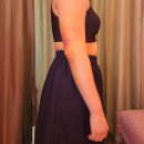 훔친돼지뒤통 | 팔뚝 람스 당일 후기｜왕근육 돼지의 저고리살 빼는법 리얼 체험기(+일주일 후기)